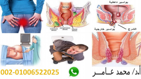 gallery/البواسير و الشرخ الشرجي