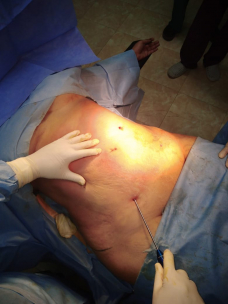 gallery/img-20190402-wa0009